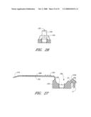 Anchoring System For a Catheter diagram and image