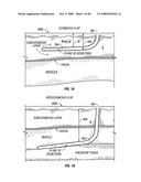 Method and apparatus for surgical dissection diagram and image