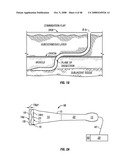 Method and apparatus for surgical dissection diagram and image