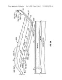 Method and apparatus for surgical dissection diagram and image