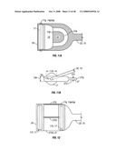 Method and apparatus for surgical dissection diagram and image