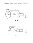 Method and apparatus for surgical dissection diagram and image