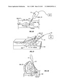 Method and apparatus for surgical dissection diagram and image