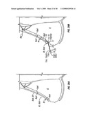 Method and apparatus for surgical dissection diagram and image