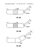 Method and apparatus for surgical dissection diagram and image