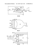 Method and apparatus for surgical dissection diagram and image