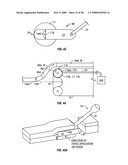 Method and apparatus for surgical dissection diagram and image