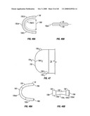 Method and apparatus for surgical dissection diagram and image