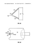 Method and apparatus for surgical dissection diagram and image