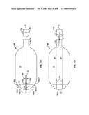 Method and apparatus for surgical dissection diagram and image