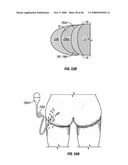 Method and apparatus for surgical dissection diagram and image