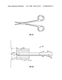 Method and apparatus for surgical dissection diagram and image