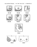 Method and apparatus for surgical dissection diagram and image