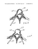 Dual incision disc repair device and method diagram and image
