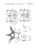 Dual incision disc repair device and method diagram and image