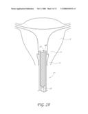 METHOD AND DEVICE FOR DISTENDING A GYNECOLOGICAL CAVITY diagram and image