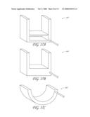 METHOD AND DEVICE FOR DISTENDING A GYNECOLOGICAL CAVITY diagram and image