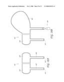 METHOD AND DEVICE FOR DISTENDING A GYNECOLOGICAL CAVITY diagram and image