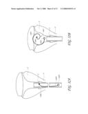 METHOD AND DEVICE FOR DISTENDING A GYNECOLOGICAL CAVITY diagram and image