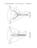 METHOD AND DEVICE FOR DISTENDING A GYNECOLOGICAL CAVITY diagram and image