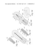 METHOD AND DEVICE FOR DISTENDING A GYNECOLOGICAL CAVITY diagram and image