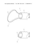 METHOD, SYSTEM AND DEVICE FOR TISSUE REMOVAL diagram and image