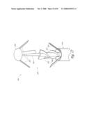 METHOD, SYSTEM AND DEVICE FOR TISSUE REMOVAL diagram and image