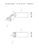 METHOD, SYSTEM AND DEVICE FOR TISSUE REMOVAL diagram and image