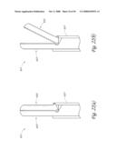 METHOD, SYSTEM AND DEVICE FOR TISSUE REMOVAL diagram and image