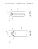 METHOD, SYSTEM AND DEVICE FOR TISSUE REMOVAL diagram and image