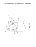 METHOD, SYSTEM AND DEVICE FOR TISSUE REMOVAL diagram and image