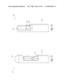 METHOD, SYSTEM AND DEVICE FOR TISSUE REMOVAL diagram and image