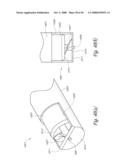 METHOD, SYSTEM AND DEVICE FOR TISSUE REMOVAL diagram and image