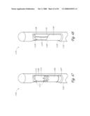 METHOD, SYSTEM AND DEVICE FOR TISSUE REMOVAL diagram and image