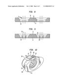 Bone Connection Device diagram and image