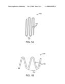 Stent With Therapeutic Agent Delivery Structures in Low Strain Regions diagram and image