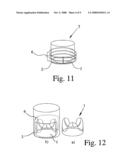 Mrt-Compatible Valve Prosthesis for Use in the Human or Animal Body for Replacement of an Organ Valve or a Vessel Valve diagram and image
