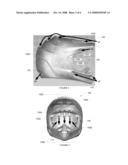 HELMET diagram and image