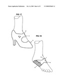 PROTECTIVE FOOT MEMBRANE diagram and image