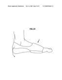 PROTECTIVE FOOT MEMBRANE diagram and image
