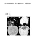 PROCESS FOR JOINING MATERIALS USING BULK METALLIC GLASSES diagram and image