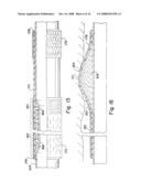 Annular Isolators for Expandable Tubulars in Wellbores diagram and image