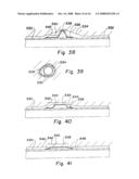 Annular Isolators for Expandable Tubulars in Wellbores diagram and image