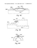 Annular Isolators for Expandable Tubulars in Wellbores diagram and image