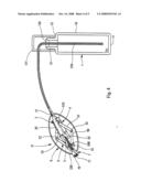 Fluid Product Dispenser diagram and image