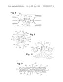 Indexing dithering mechanism and method diagram and image