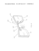 Detachable shelter frame for spectacles diagram and image