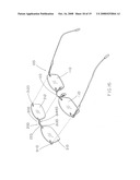 Detachable shelter frame for spectacles diagram and image