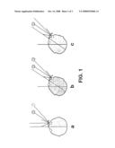 Polarizing Ophthalmic Lens Adapted to a Wearer s Eye/Head Behavior diagram and image