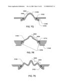 Sensor Apparatus Systems, Devices and Methods diagram and image